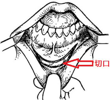 image00354888888888888888888888888888888.png