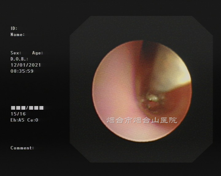 图3_副本.png