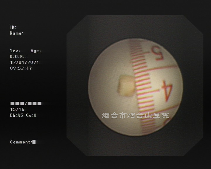 图4_副本.png