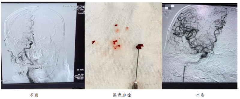 神经内科1.png