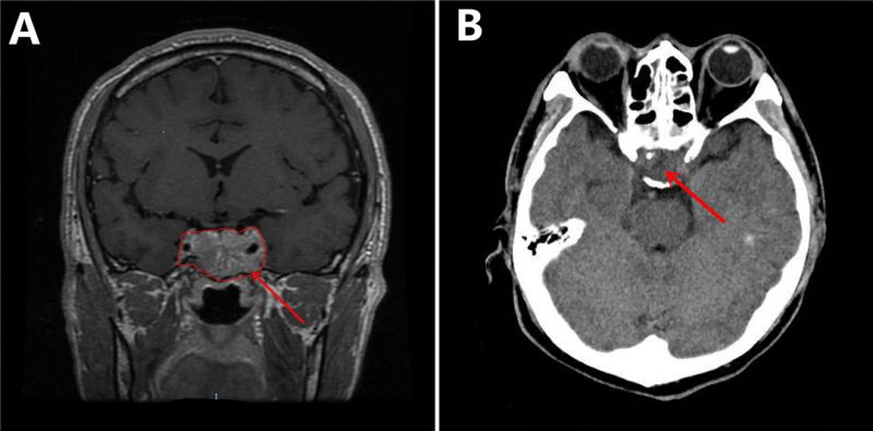 fig.3.jpg