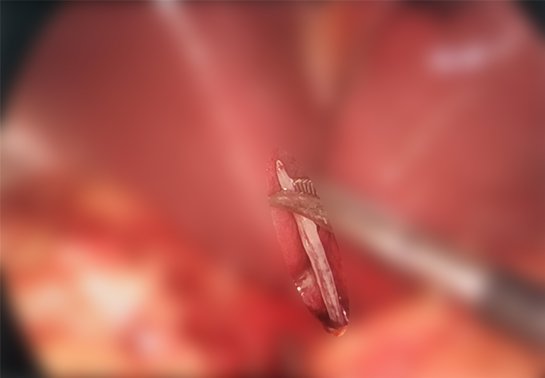9174f8a591312b4f37098610538ec843.png