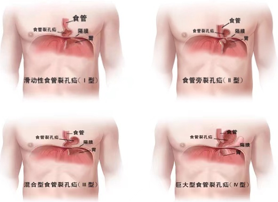 QQ截图20240408150600.png